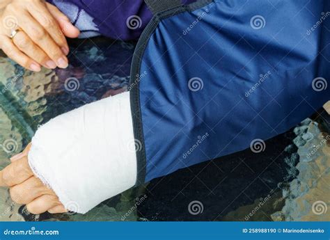 Broken Arm with Plaster Cast in Wearing Bandage To Support Injured Arm ...