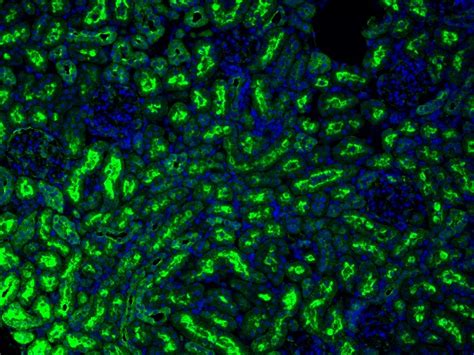 CoraLite®Plus 488-Tyramide Reagent PR30022 | Proteintech