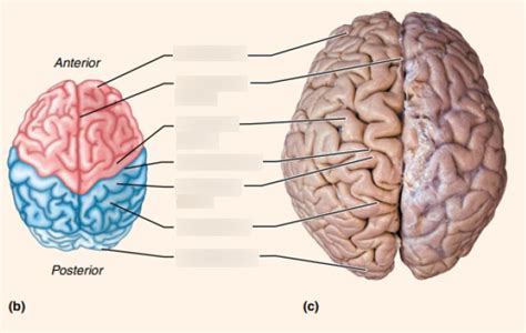Image result for Contralateral Hemisphere