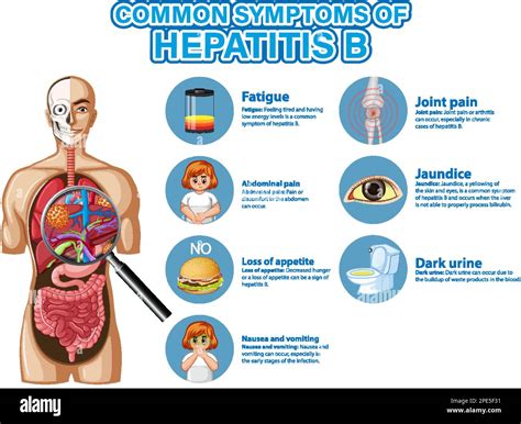 Hepatitis B: Symptoms, Treatment And Prevention Tips – BXXM