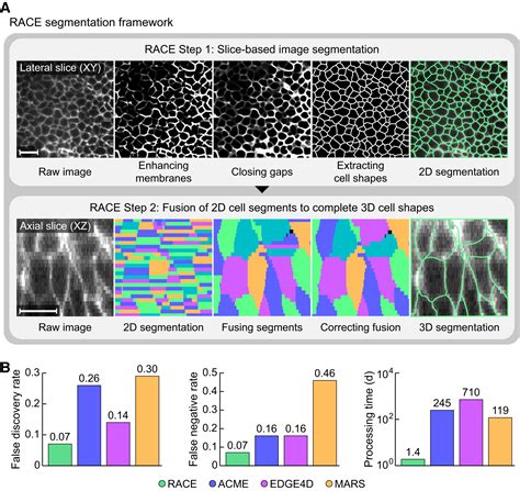 Image result for Cell Segmentation Methods
