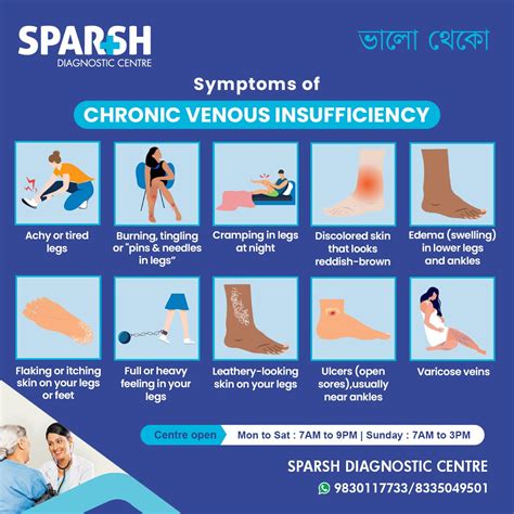 Chronic Venous Insufficiency: Causes, Symptoms, Diagnosis, and Treatment - Sparsh Diagnostic Center