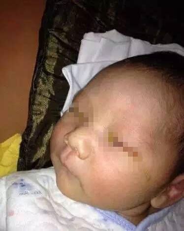 闪光灯易伤婴儿眼睛?专家:影响并不大