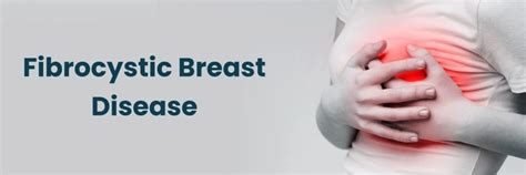Understanding Fibrocystic Breast Disease