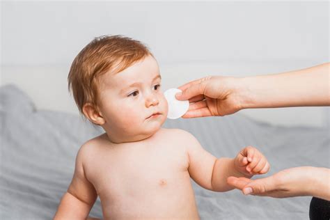 Baby Acne Treatments: What Parents Should Know