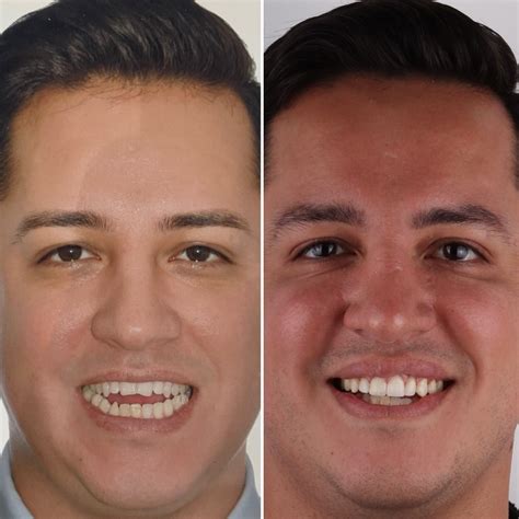 Ortodoncia - Dr Eluani