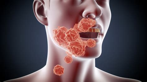 Image result for Cancer Detection Using Graph CNN