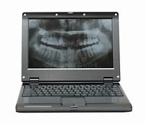 Image result for Dented Laptop