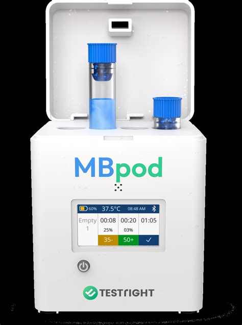 MBscan: Improve Milk Quality with Automated and Authentic MBRT Data ...