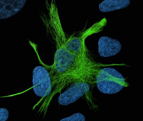 Image result for Astrocyte