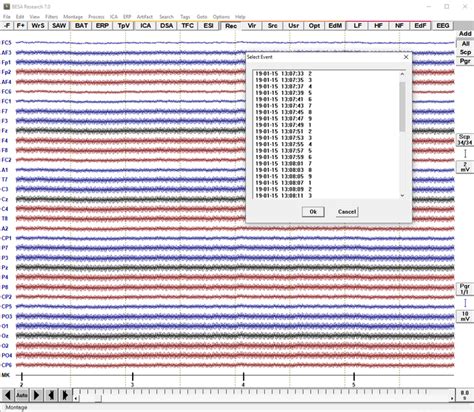 Image result for Convert EDF File to MAT-file