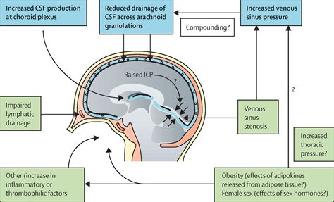 Understanding idiopathic intracranial hypertension: mechanisms ...