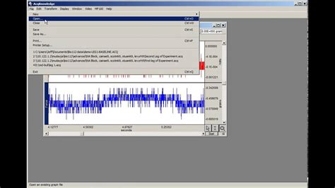 Image result for Myogram