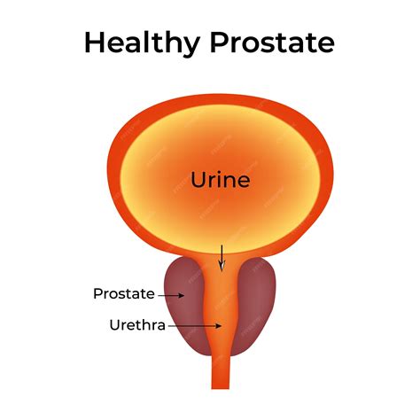 Healthy prostate prostate urethra urine vector illustration | Premium Vector - illustration of urethral sound