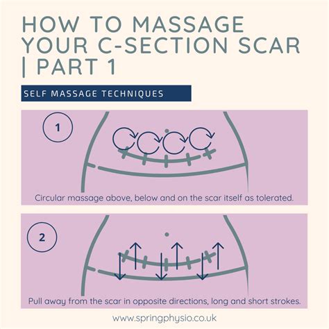 How to massage a c section scar | c-section massage