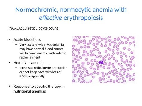 Anemia update diagnosis and management .pptx