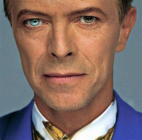 David Bowie and his heterochromia (eyes of different colours) | David ...