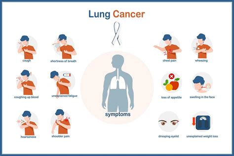 Chest Pain Shortness Of Breath Lung Cancer at Elaine Boehme blog