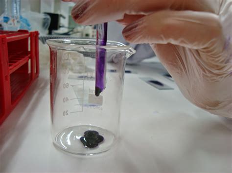 CUADERNO DE PRÁCTICAS HEMATOLOGÍA: Práctica: Detección de cuerpos de Heinz.