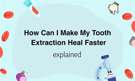 How Can I Make My Tooth Extraction Heal Faster