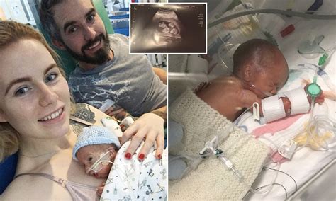 27 weeks premature - hiccups pregnancy