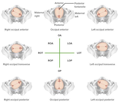 Fetal Malpresentation and Malposition | Concise Medical Knowledge