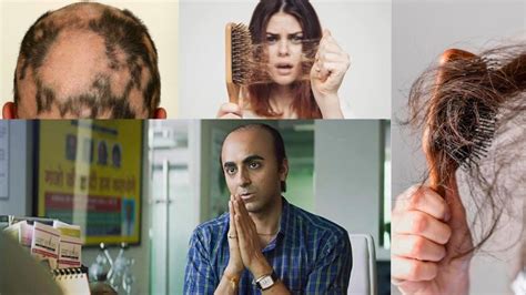 Image result for Computer Slow Hair Fall