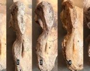 ACTA Medica International — Global Peer-Reviewed Medical Journal