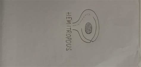 Horizontally oriented ovules are called A) Hemitropous B ...