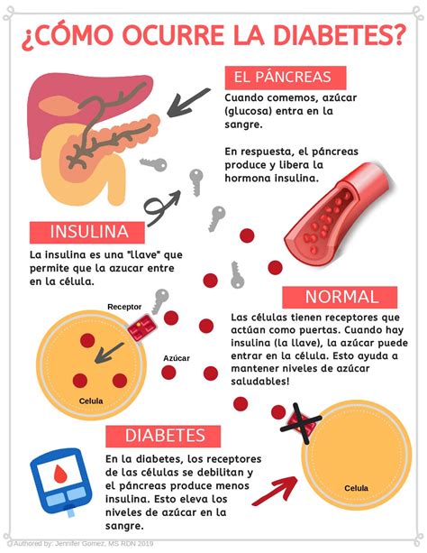 Diabetes In Spanish Information at Christopher Brunell blog