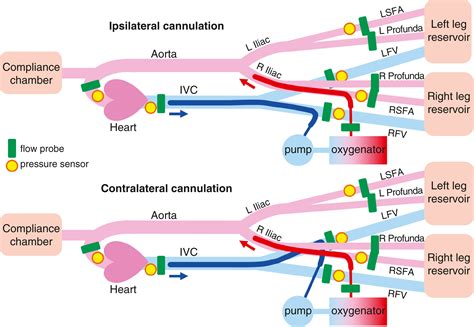 Hemodynamic considerations of ipsilateral versus contralateral ...