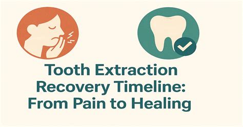 Things Needed for Tooth Extraction Recovery 的图像结果