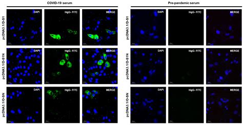 Vaccination with Plasmids Encoding the Fusion Proteins D-S1, D-S1N and ...