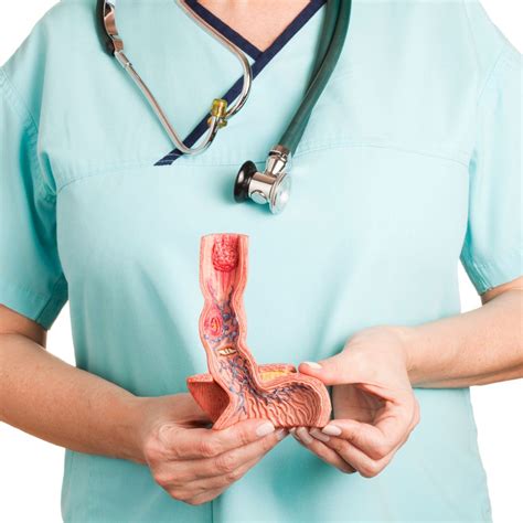 Update der Chicago-Klassifikation für Motilitätsstörungen des Ösophagu ...