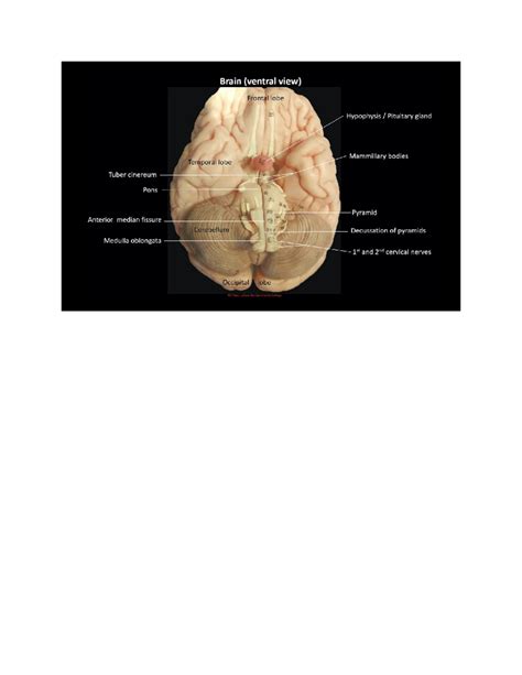 Ventral brain - anatomy - Brain (ventral view) Frontal lobe Hypophysis ...