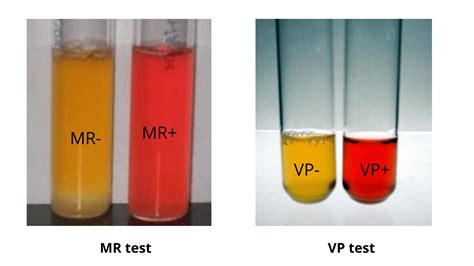IMViC test procedure, Purpose, Result, and Organism List. - Biology ...