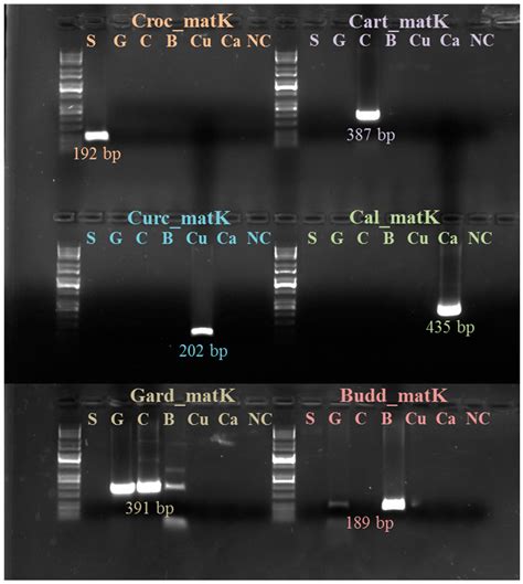 Genetic and Epigenetic Approaches for the Possible Detection of ...