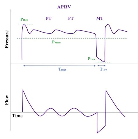 Image result for APRV Mode Explained