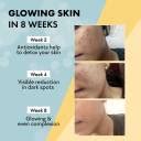 Chicnutrix Glow - Japanese OPITAC Glutathione & Vitamin C for bright ...