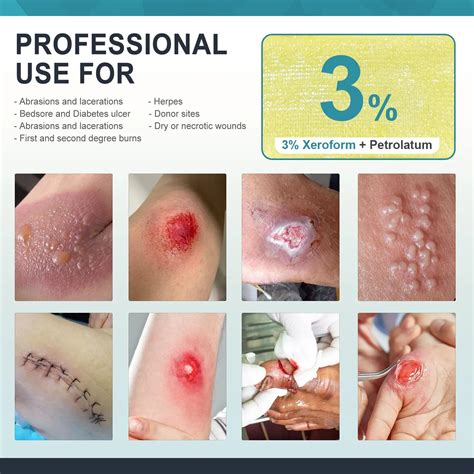 Ceeport Wound Dressing for Better Life – CEEPORT