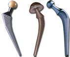 JointSurgery.in Types of Hip Replacement - JointSurgery.in