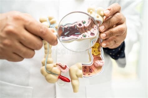 Image result for Digestive System Appendix