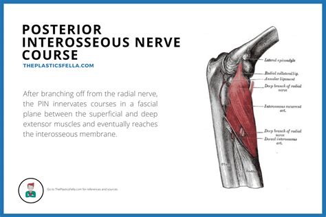 Posterior Interosseous Nerve Syndrome Vs Radial Tunnel Syndrome - Captions Profile