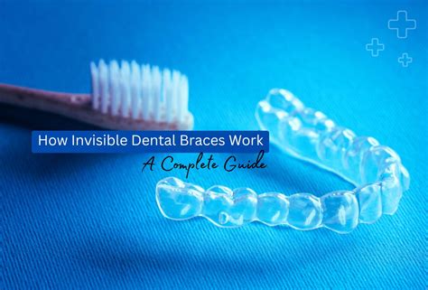 How Invisible Dental Braces Work: A Complete Guide | Teethcare