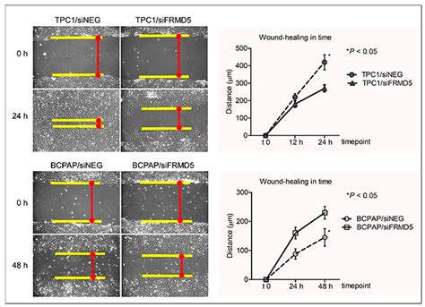 Analysis of the Role of FRMD5 in the Biology of Papillary Thyroid Carcinoma