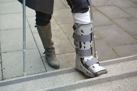 What Ankle Fracture Treatment Is Right For You? - Town Center Orthopaedics