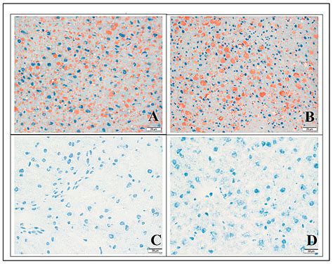 Choline Supplementation Prevents a Hallmark Disturbance of Kwashiorkor ...
