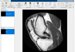 MATLAB Color Segmentation 的图像结果