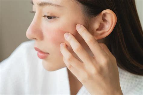 The Role of Ferments (Like Lactobacillus) in Skin Barrier Repair – Glopetra