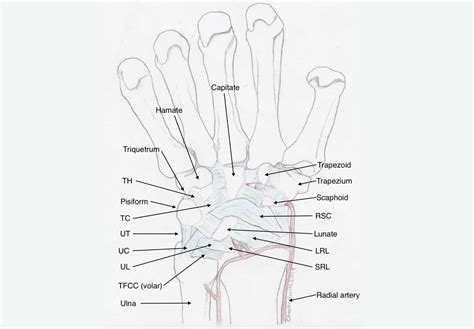 Dorsal Wrist Impingement Symptoms